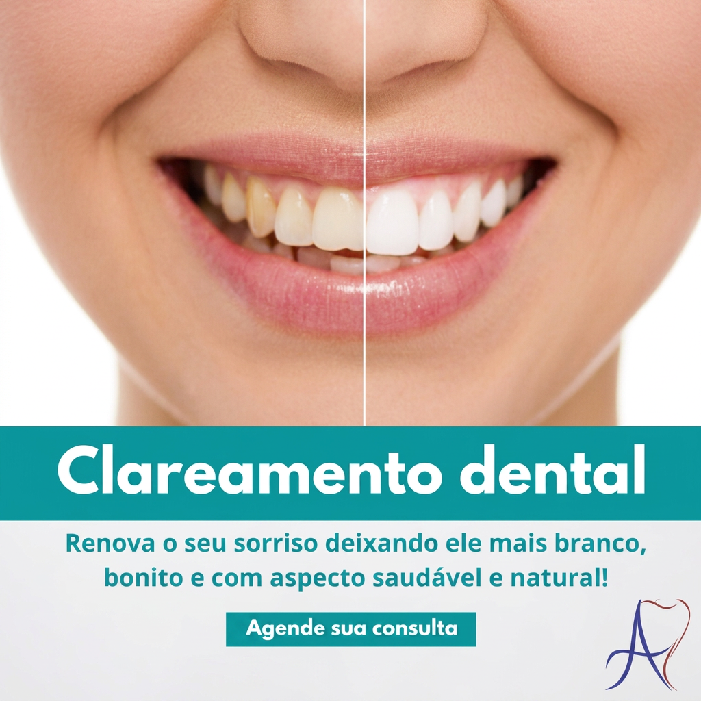Antes e depois de clareamento dental